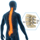 Bone Biologics Corporation